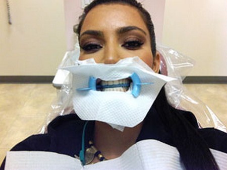 Снимок Ким Кардашиан из кабинета стоматолога