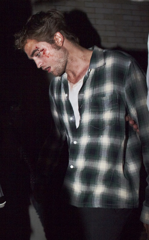 Роберт Паттинсон истекает кровью на съемочной площадке