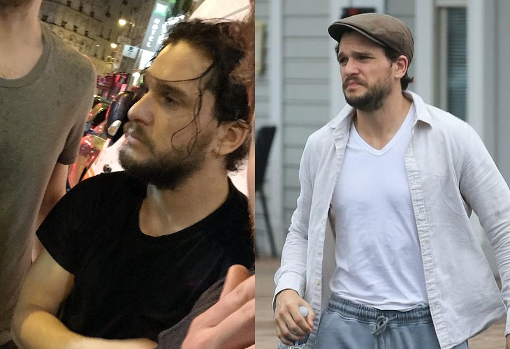 До и после: в сети появились фото пьяного Кита Харингтона в Париже и новые снимки из клиники