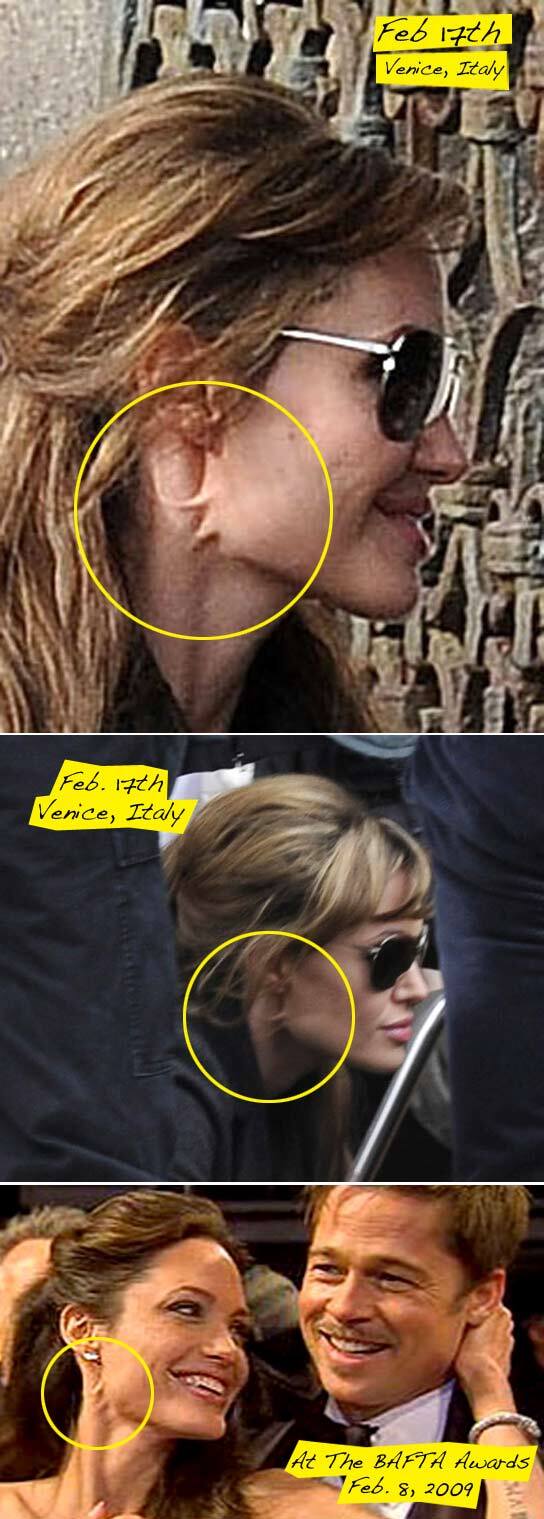 Проблемы на лице Анджелины Джоли - не фотошоп