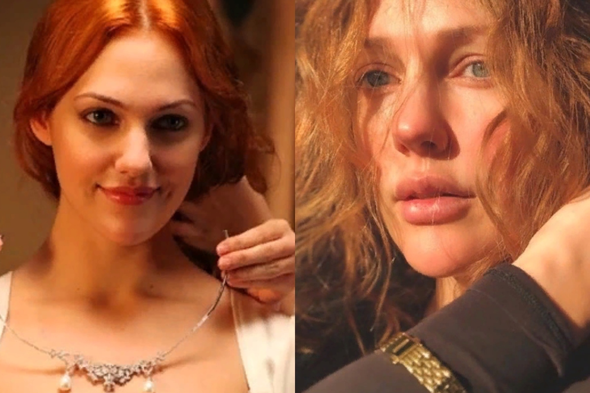 Большая разница: 5 турецких актрис до и после пластики