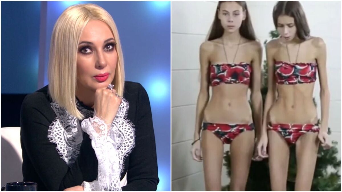 Близняшки из шоу Кудрявцевой чуть не умерли от анорексии: их преображение способно удивить (фото)