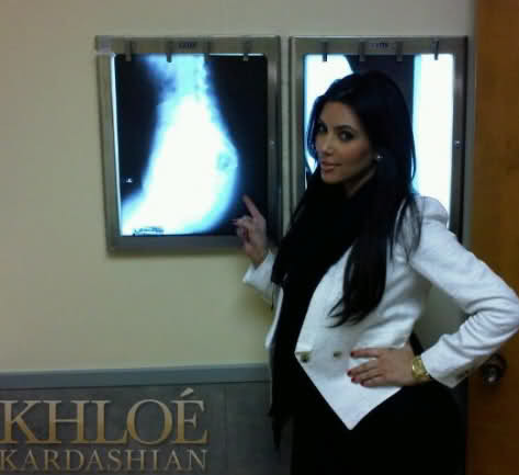 Ким Кардашиан сделала рентген, чтобы доказать, что ее попа настоящая